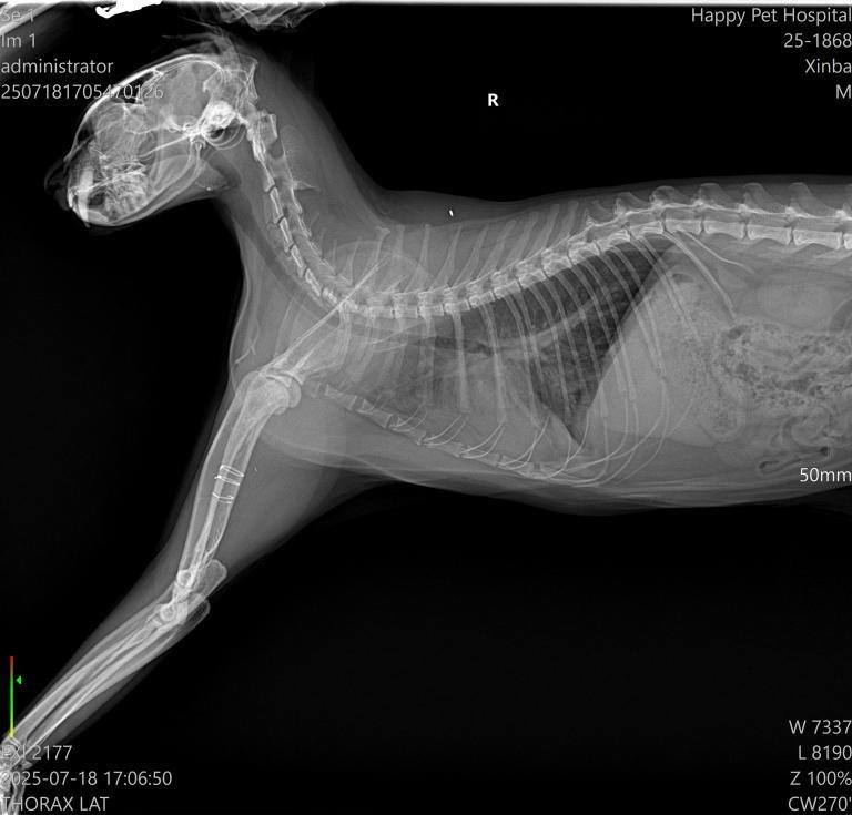 Xinba thoracic X-ray lateral view